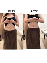 ジョワイユ(Joyeux)/腸の位置でお腹は変わる