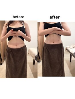 ジョワイユ(Joyeux)/腸の位置でお腹は変わる