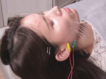 経堂鍼灸整体院/美容鍼の雰囲気