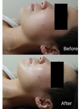 ハートランド(HEARTLAND)/