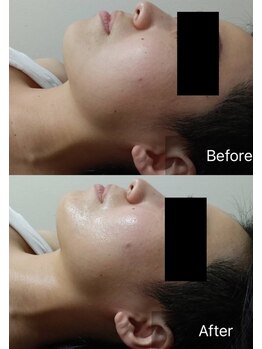 ハートランド(HEARTLAND)/