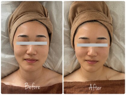 コニワ(528hz)の写真