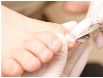 ぱれっとの写真/【美爪＆トラブル爪ケア】プロにお任せ！適正な長さに整え、美しい足元へ♪巻爪・形・厚みなどのお悩みも◎