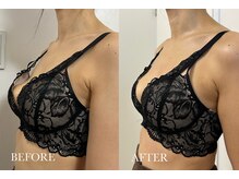 リノア(Linoa)/ふわもちバストアップ