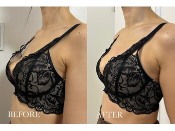 リノア(Linoa)/ふわもちバストアップ