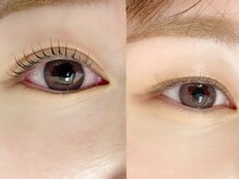 アイクイーン 亀戸(Eyequeen)/