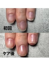 ココ(COCO)/広がり気味だったお爪