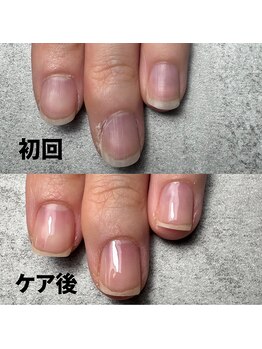 ココ(COCO)/広がり気味だったお爪