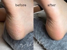 ナル(null)/かかと・足裏角質ケア