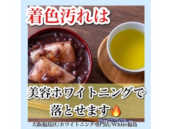 ホワイトニングサロン ホワイト(WHITE)/セルフホワイトニング/大阪/福島