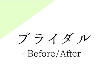 シードリン(Seedling)/