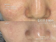 コウル 川西能勢口店(geoul)/毛穴レス美肌コース4回