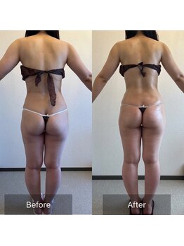 サロン ド カシェット 銀座/筋骨リンパマッサージ痩身/お腹