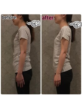 プルーム 大橋店(plume)/40代女性/肩こり、猫背