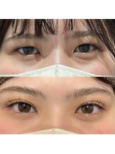 アイドット(EYE.)/EYE.ラッシュリフトまつげパーマ