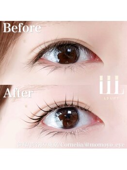 コーネリア(Cornelia)/#L3リフト#メーテルロッド