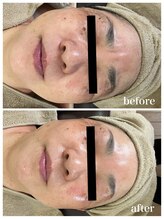 ジャスミン(Jasmin)/エステティック×シェービング