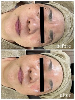 ジャスミン(Jasmin)/エステティック×シェービング