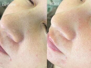 テオリア(TEORIA)/