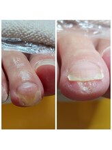 爪切り屋 足楽/