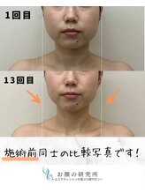 お顔の研究所/ビフォーアフター写真♪