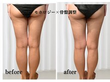 オトサロン(Otosalon)/夏に向けて引き締め！痩身