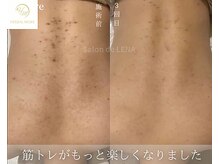 サロンドレナ 名駅店/ハーブピーリング サロンドレナ