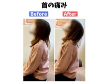 美波整体院 本宮院/首の痛み(Before After)