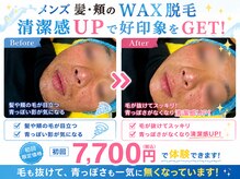プルメリア