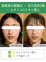 ブプラ 代々木上原店(BUPURA)/小顔×肌質改善