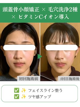 ブプラ 代々木上原店(BUPURA)/小顔×肌質改善