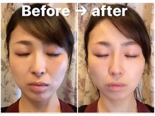 カンコルギセラピー 広島幟町店(KAN)/No1小顔コルギ