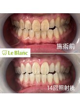 ルブラン 奈良店(Le Blanc)/通い放題 途中経過♪