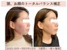 3D designing facial【骨格をデザインする小顔矯正】　60分　￥13200→￥9900