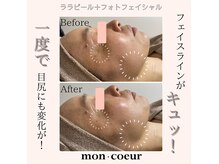 モンクール(mon coeur)の雰囲気（ララピール×フォトでフェイスラインを引き締め！）