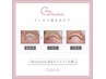 【nailsalon Qum 】FOOT ★巻き爪改善/親指１本　5,500円