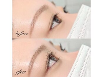 プレッシュ(Presh)/パリジェンヌビフォーアフター