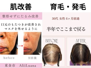 アリィルアナ(Alii Luana)