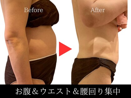 トータルエステティック ビューティスト 足利店(Total Easthetic Beautist)の写真