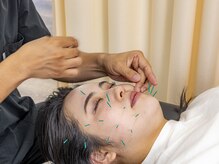 いとしまリハキュア整骨院/美容はり