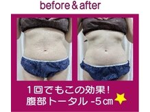 メイ(Mey)の雰囲気（効果の出にくいお腹腰回り「ぐるっと360度」施術でスッキリ◎）