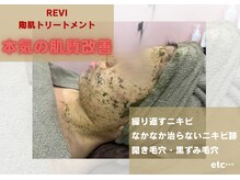 バルディーナ(BALDINA)