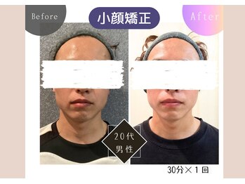 矢板はなぶさ接骨院の写真/「清潔感は、男の身だしなみ」
脱毛だけじゃない。肌・身体・疲れまで、トータルで整えるメンズケア。