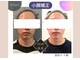 矢板はなぶさ接骨院の写真/「清潔感は、男の身だしなみ」
脱毛だけじゃない。肌・身体・疲れまで、トータルで整えるメンズケア。