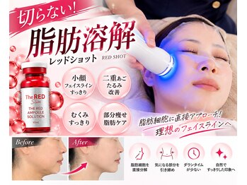 ポルテ バイ ハルモ(porte by Harmo)の写真/【40代からの小顔ケア】二重あご・フェイスラインのもたつきに！切らない脂肪ケアでスッキリ小顔へ♪