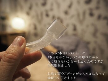 ウルケ(URUKE)/毛穴徹底洗浄