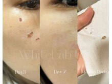 エレノア(ERENOR)/ホワイトラボ