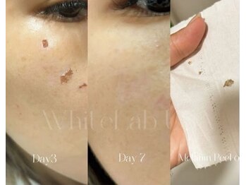 エレノア(ERENOR)/ホワイトラボ