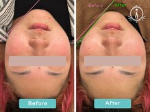 アイ(i)/ビフォーアフター