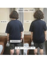 スイッチ 浜松町大門(SWITCH)/不良姿勢のケア例